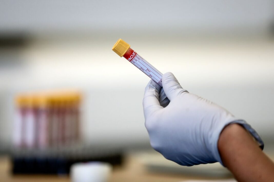hiv test in dubai
